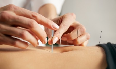 Danforth Community Acupuncture